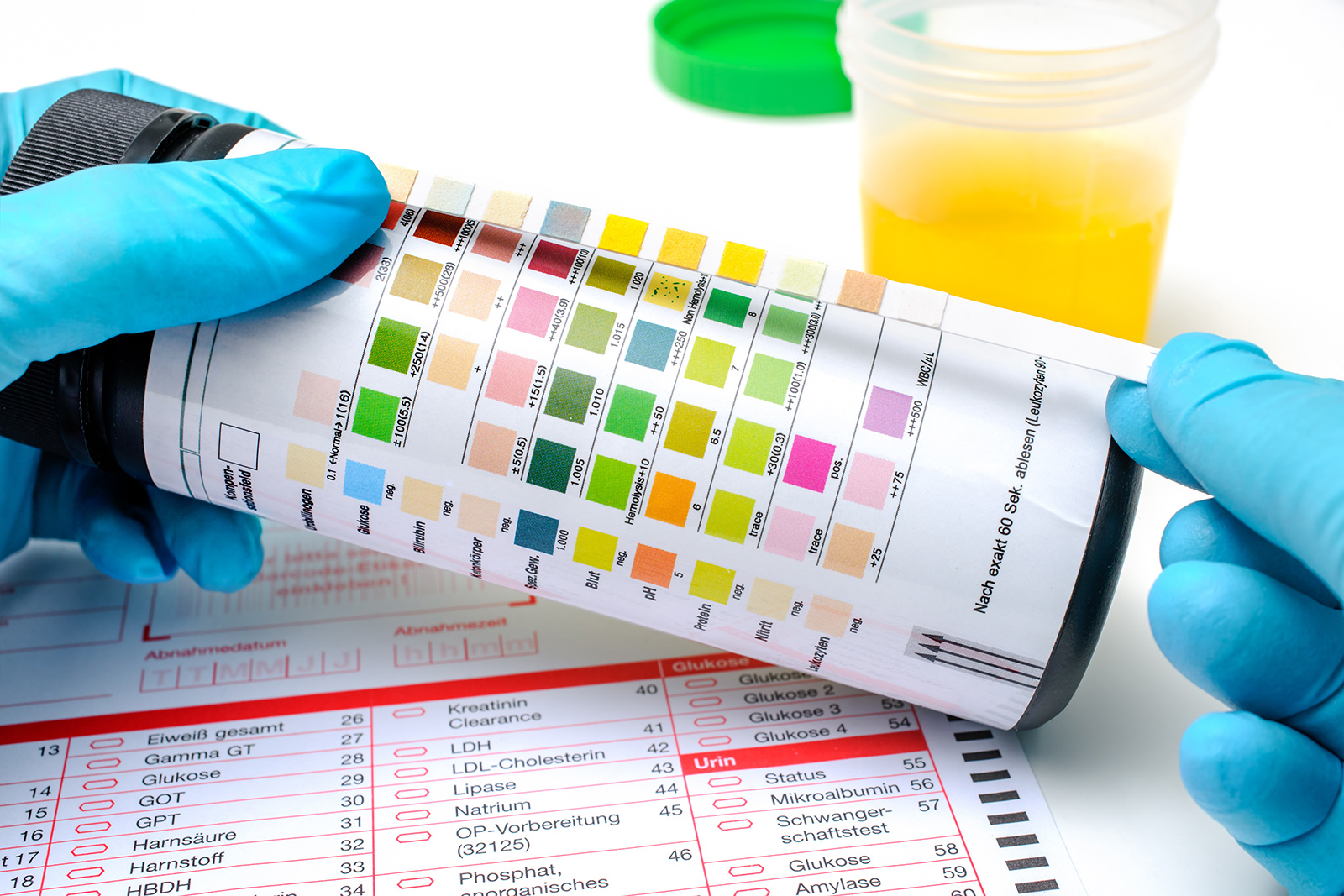 Teststreifen für der Ermittlung des pH-Werts einer Urinprobe